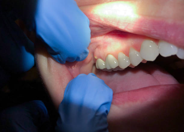 Best Emergency Dental Services Near Me  in Boonville, CA
